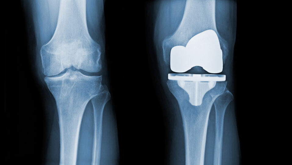 orthopedic surgeon x rays